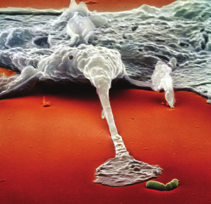 Electron micrograph of a macrophage extending a pseudopod toward a bacterium